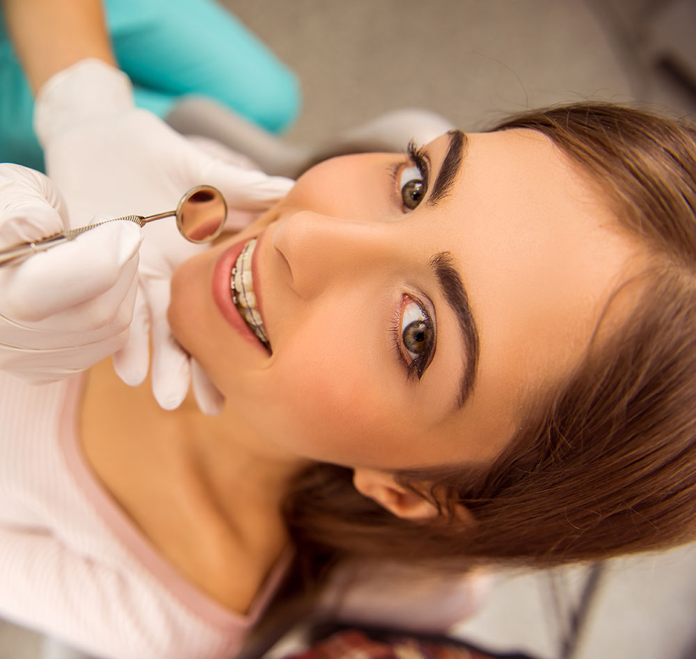 Metal Braces Whittier CA