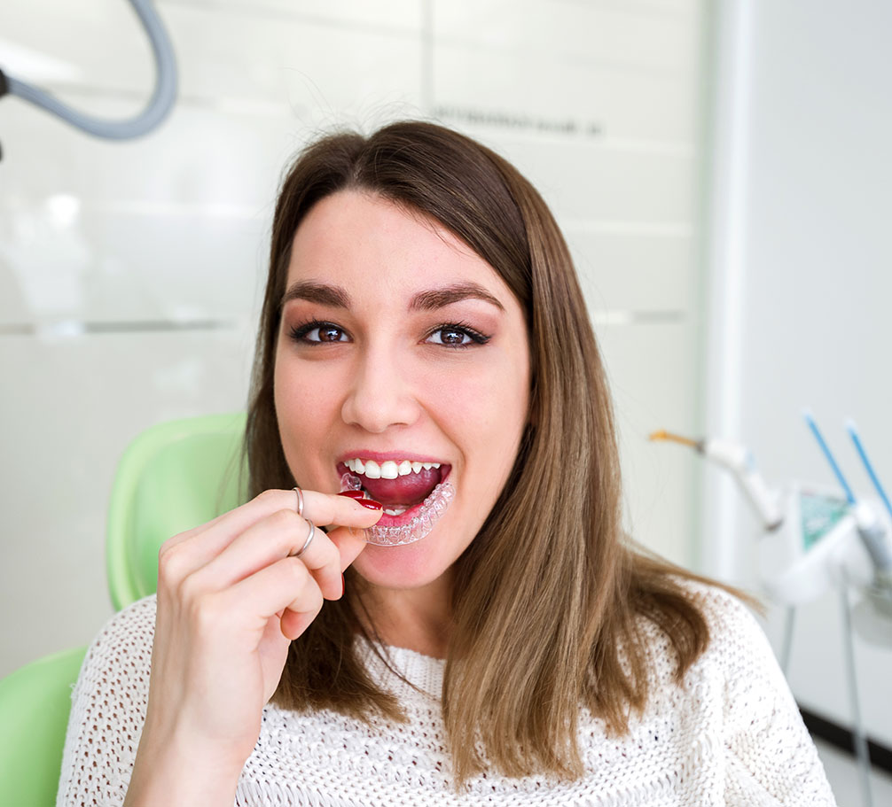 Invisible Braces Whittier CA