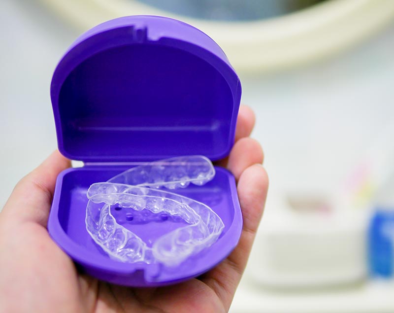 Retainers in Whittier CA